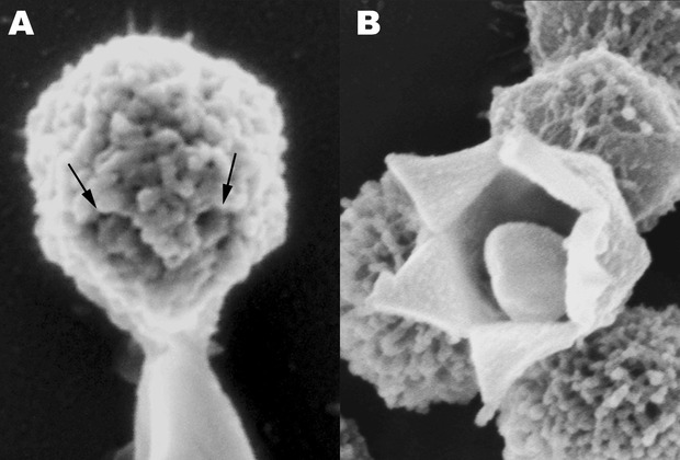 Раскрытие капсида мимивируса при нагревании. Изображение: Zauberman N, Mutsafi Y et al., PLoS Biology, 2008